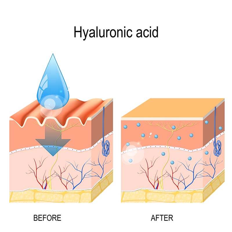 Công dụng của Hyaluronic acid